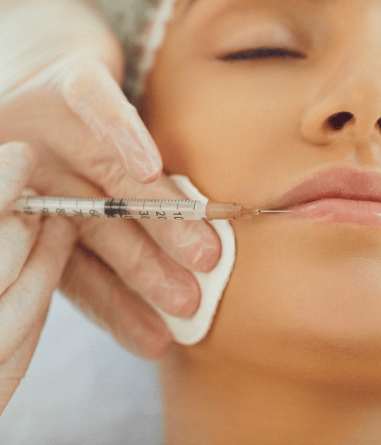 Best Lip Fillers Near Me